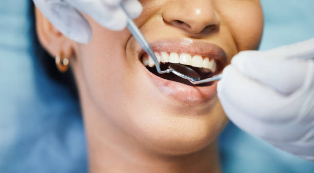 Best Emergency Root Canal Treatment in Oak Ridge, NC